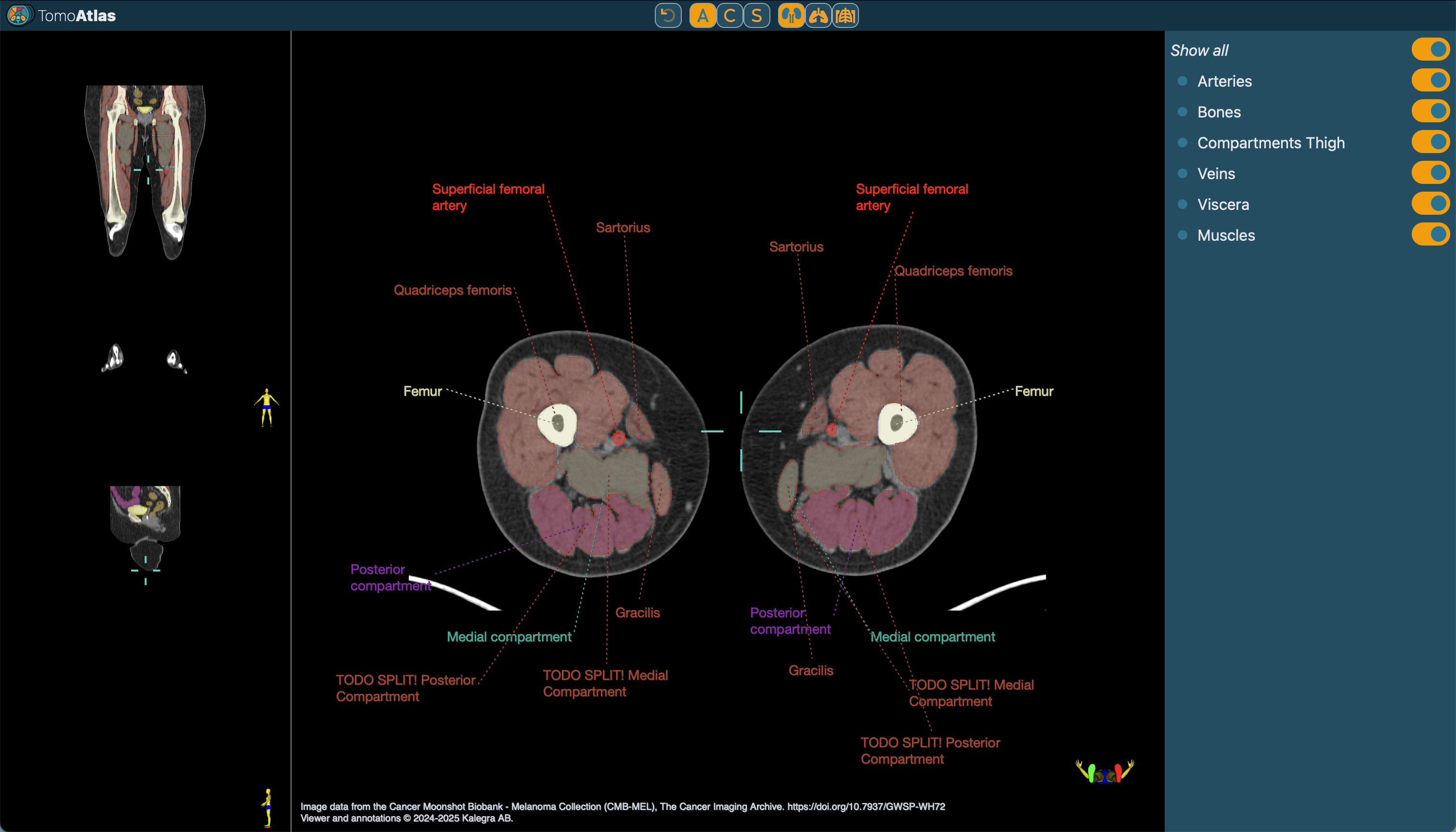 TomoAtlas screenshot